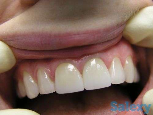 Стоматологические услуги, фотография 1