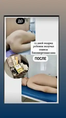 Органы под защитой биоэнергии., фотография 5