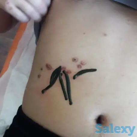 Пиявки ставим одноразовые. Очистка, омоложение , лечениеОчень много пользы., фотография 1