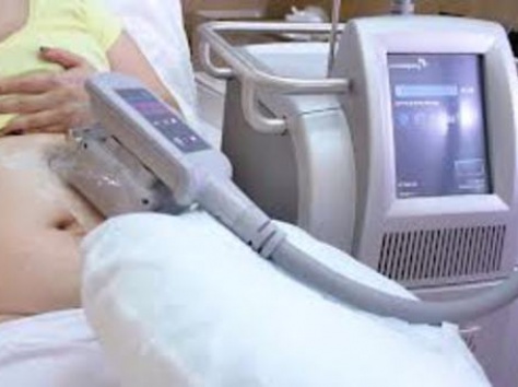 КРИОЛЕПОЛЕЗ-Липосакция замораживанием - новый высокоэффективный метод., фотография 1