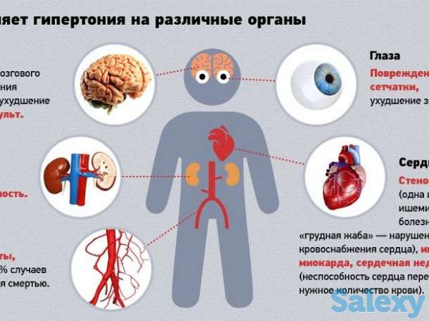 коррекция атланта, фотография 5