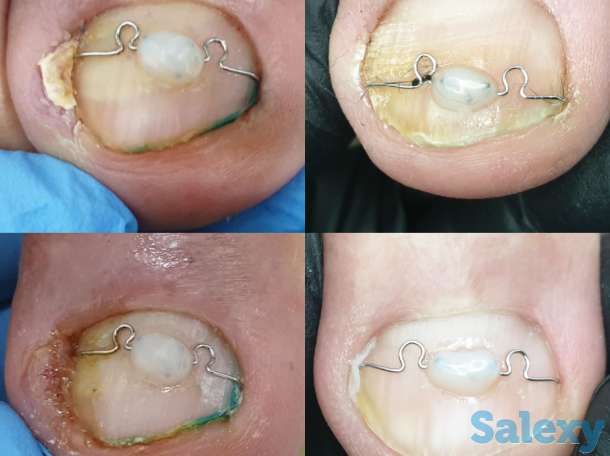 Ноги - наше всё, фотография 3