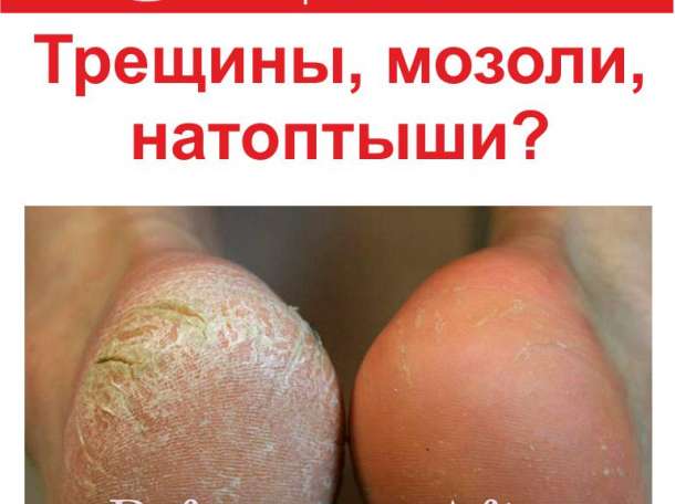 Профилактика сахарного диабета в Алматы, фотография 5