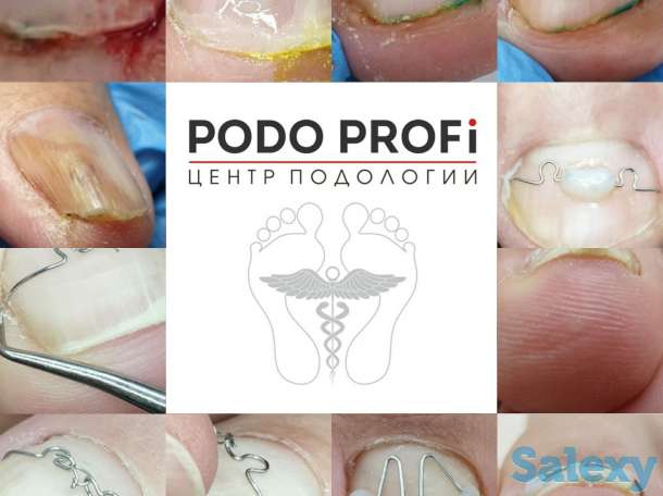 Ноги - наше всё, фотография 1