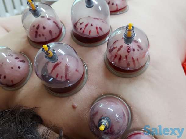 Хиджама, фотография 2