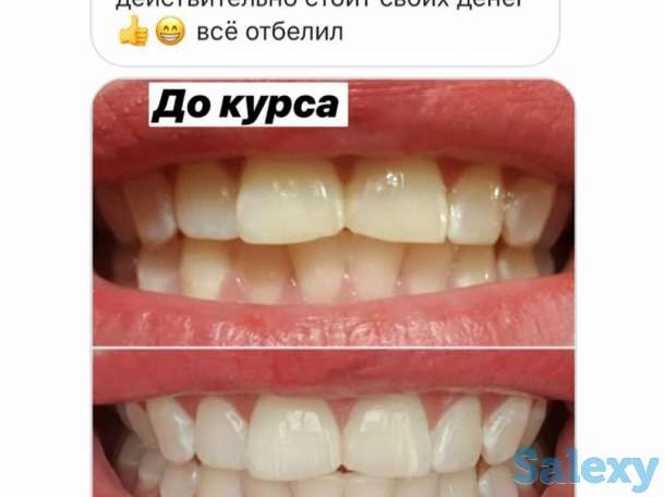 Отбеливание для зубов Happy Smile, фотография 11