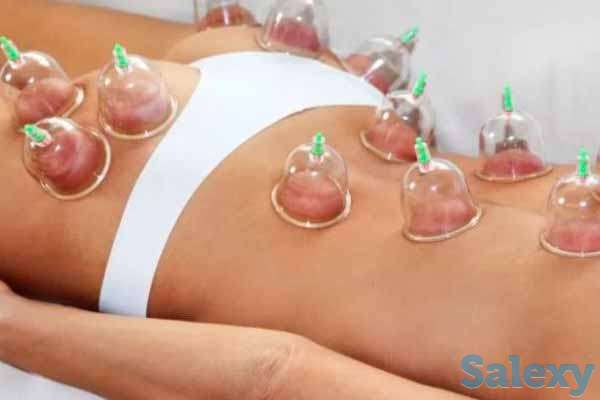 Хиджама и Массаж, фотография 1