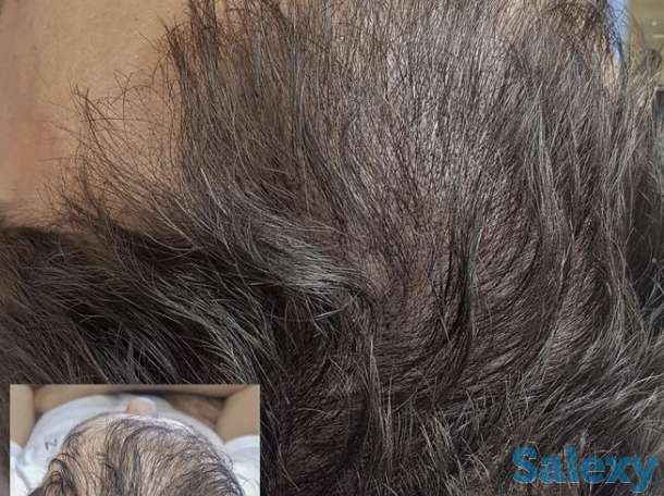 Трихопигментация головы в Алматы, фотография 4