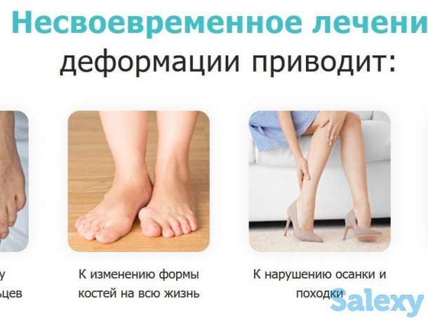 Магнитная вальгусная шина MagnetFix бандаж, фотография 2