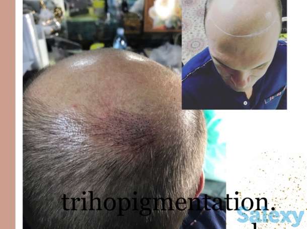 Трихопигментация головы в Алматы, фотография 6