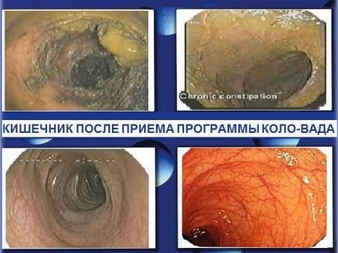 Худеем и очищаем организма комфортно, правильно и безопасно в домашних условиях, фотография 6