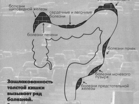 Купить Баобаб Лайф в А стане Очищение Организма, фотография 2