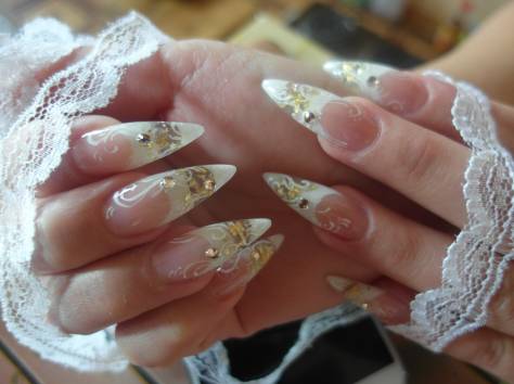 Наращивание ногей, фотография 3