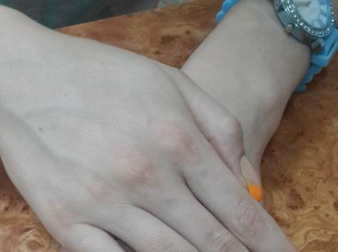 наращивание ногтей , фотография 2