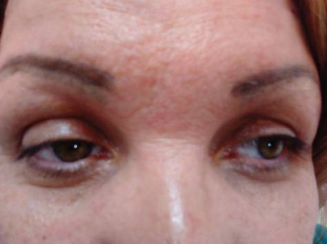 Ламинирование ресниц по технологии YUMI-LASHES, фотография 3