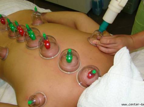 хиджама в астане, фотография 1