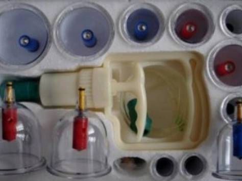 лечение хиджамой в астане, фотография 1