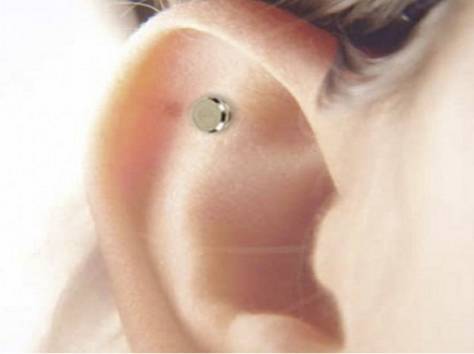 Биомагниты для похудения- Nano Slim, фотография 4