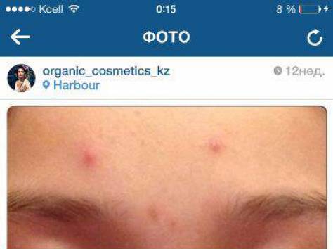 Бесплатная диагностика кожи лица, фотография 4