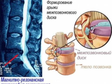 Головная боль, боль в спине и шее?Эффективное и доступное лечение!!!, фотография 2