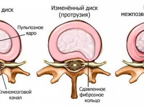 Головная боль, боль в спине и шее?Эффективное и доступное лечение!!!, фотография 3