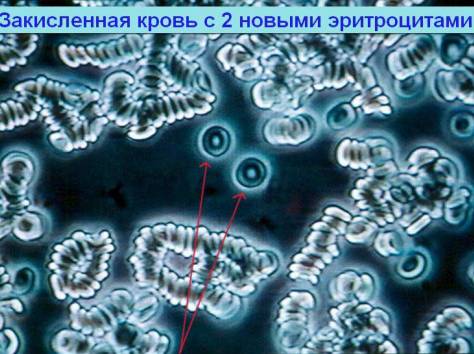 Новейшая диагностика крови, фотография 1