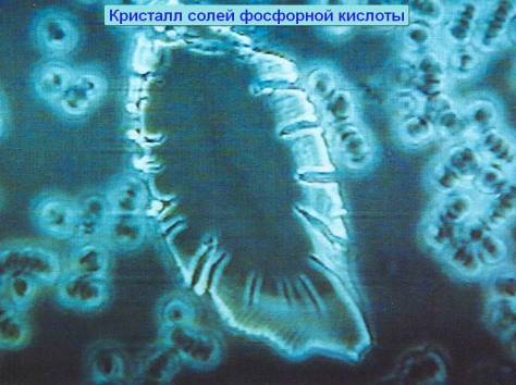 Новейшая диагностика крови, фотография 2