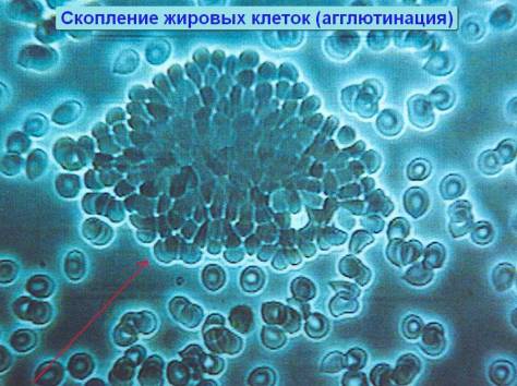 Новейшая диагностика крови, фотография 3