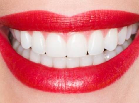 Лечение зубов качественно, фотография 1