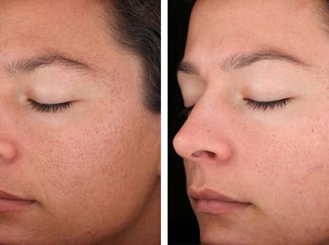 Маски для лица!, фотография 1