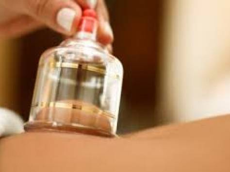 хиджама в астане , фотография 1