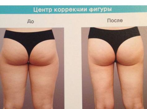 Организованные медицинские туры в Южную Корею. , фотография 3