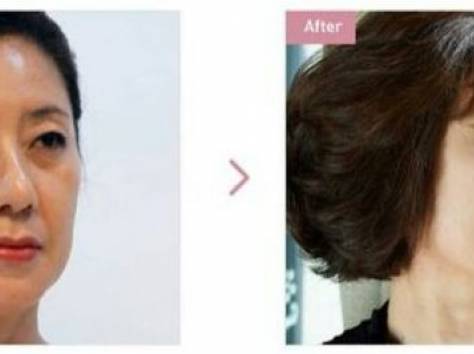 Организованные медицинские туры в Южную Корею. , фотография 4