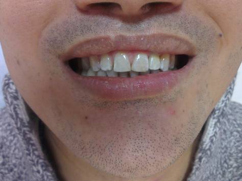 Внимание!, фотография 1