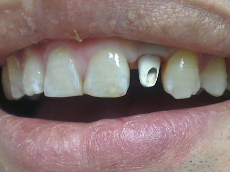 Внимание!, фотография 2