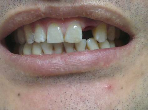 Внимание!, фотография 3