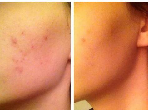 Кофейный австралийский SKRAB в Астане, фотография 1