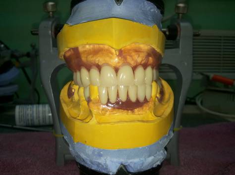 Зубной техник из России!, фотография 5