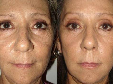 Крем против морщин Jeunesse Instantly Ageless , фотография 2