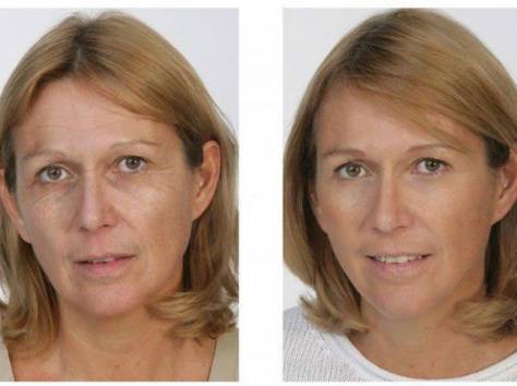 Крем против морщин Jeunesse Instantly Ageless , фотография 3