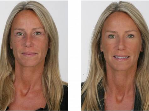 Крем против морщин Jeunesse Instantly Ageless , фотография 4