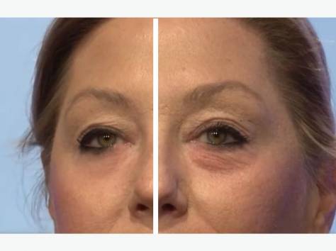 Крем против морщин Jeunesse Instantly Ageless , фотография 5