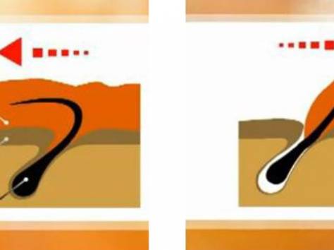 Шугаринг в Астане недорого , фотография 2