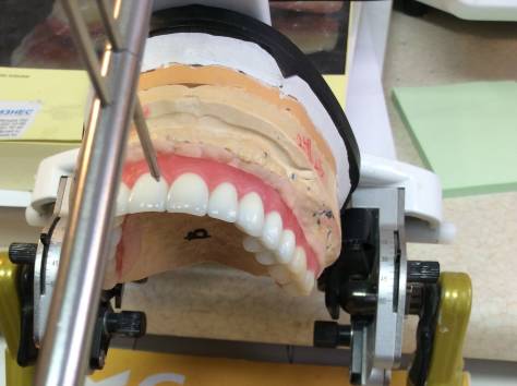 Зуботехническая лаборатория в Алматы., фотография 3