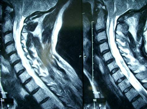 Консультация и осмотр нейрохирурга, фотография 3