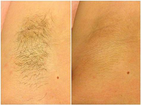 Гладкая кожа., фотография 5