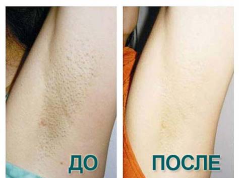 Гладкая кожа., фотография 6