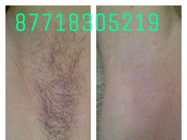 Шугаринг.Наращивание ресниц., фотография 4