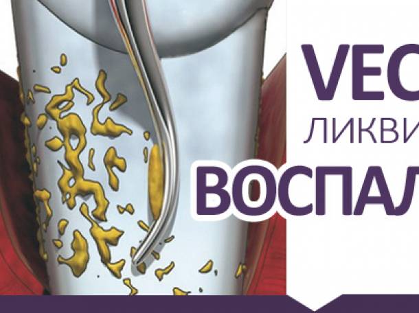 Лечение десен с аппаратом Вектор, фотография 2