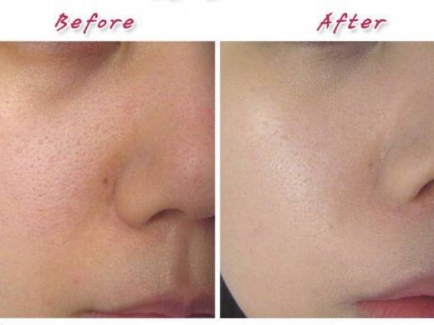 Корейская косметика высокого качества от известныx компании, фотография 2